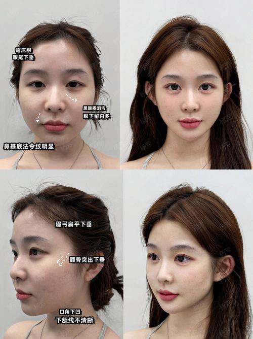 想变韩女全脸整容,想变韩女全脸整容怎么办